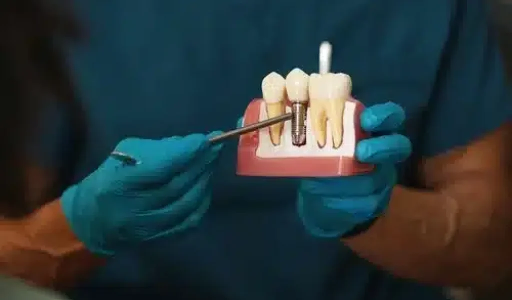 A hand holding a stone dental study model that displays a full set of upper and lower teeth in occlusion